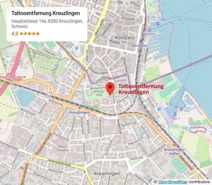 Anfahrt zum Studio Tattooentfernung